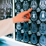 Neurociencia educación emocional