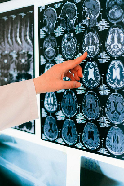 Neurociencia educación emocional